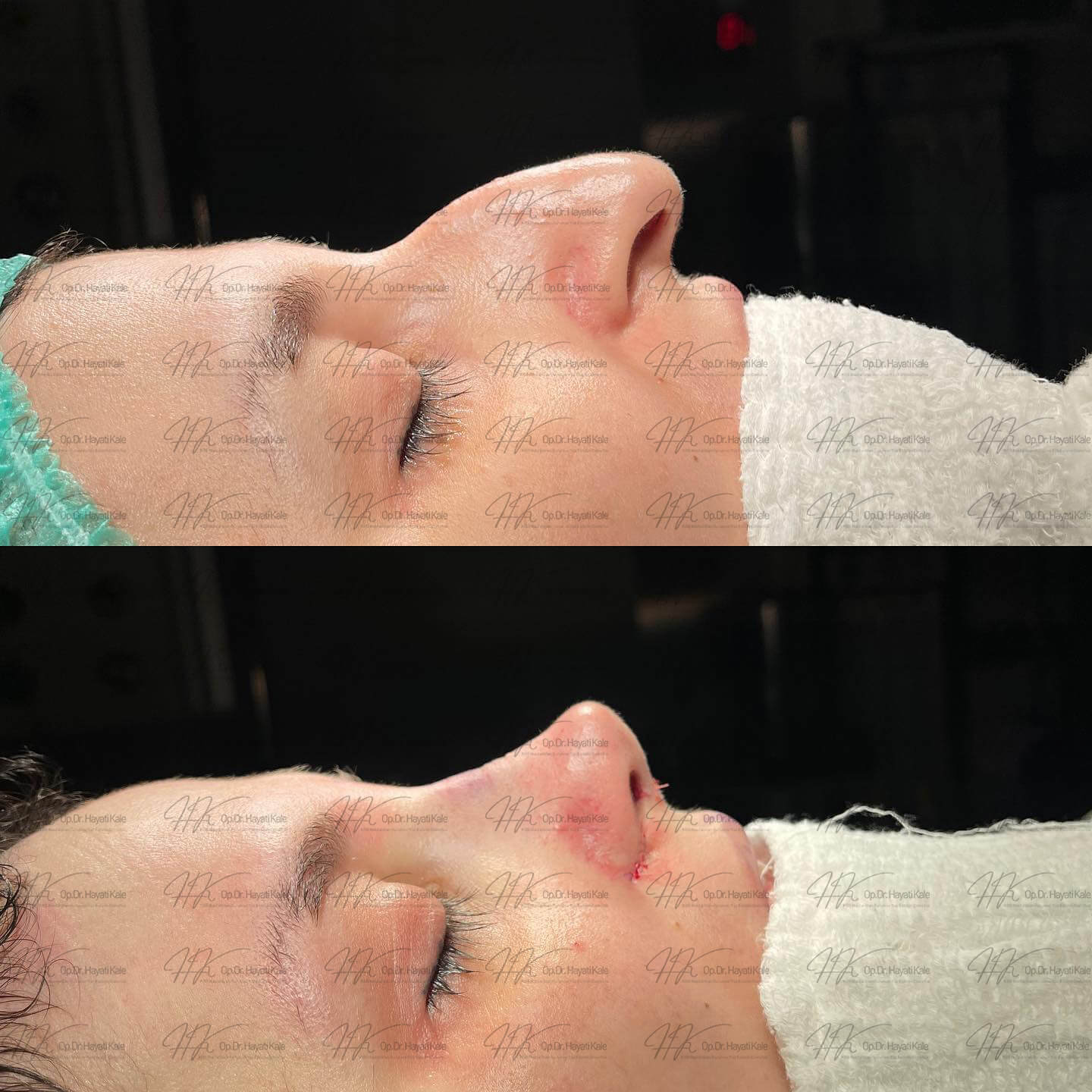 before-after