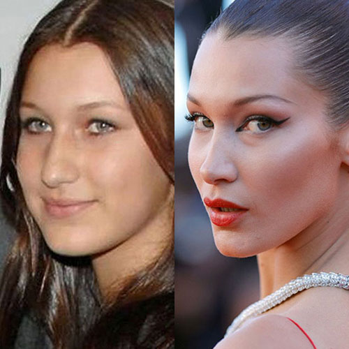 bella hadid burun estetigi