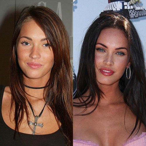 megan fox burun estetigi